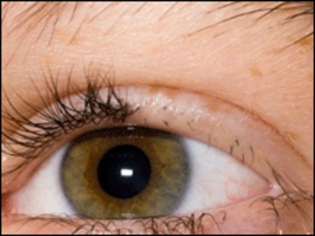 El peligroso hábito de arrancarse las cejas: causas y consecuencias