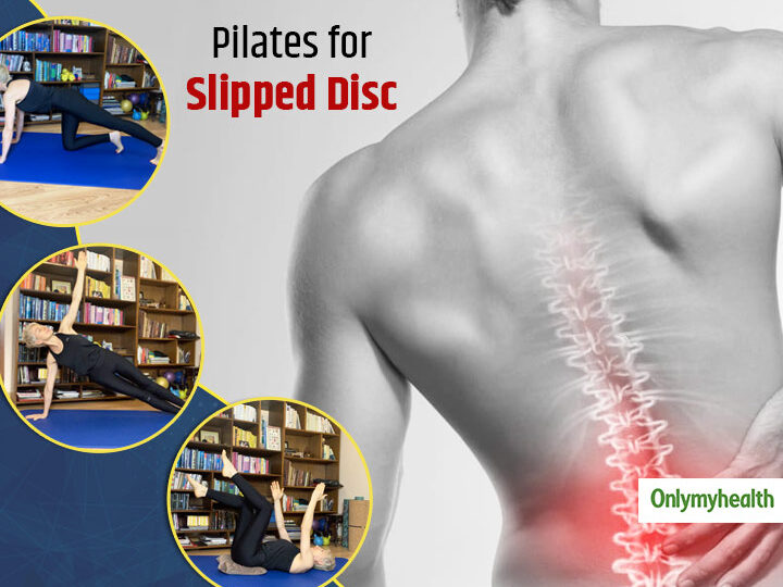 Protusión discal: Descubre cómo vivir plenamente con pilates y superar patologías